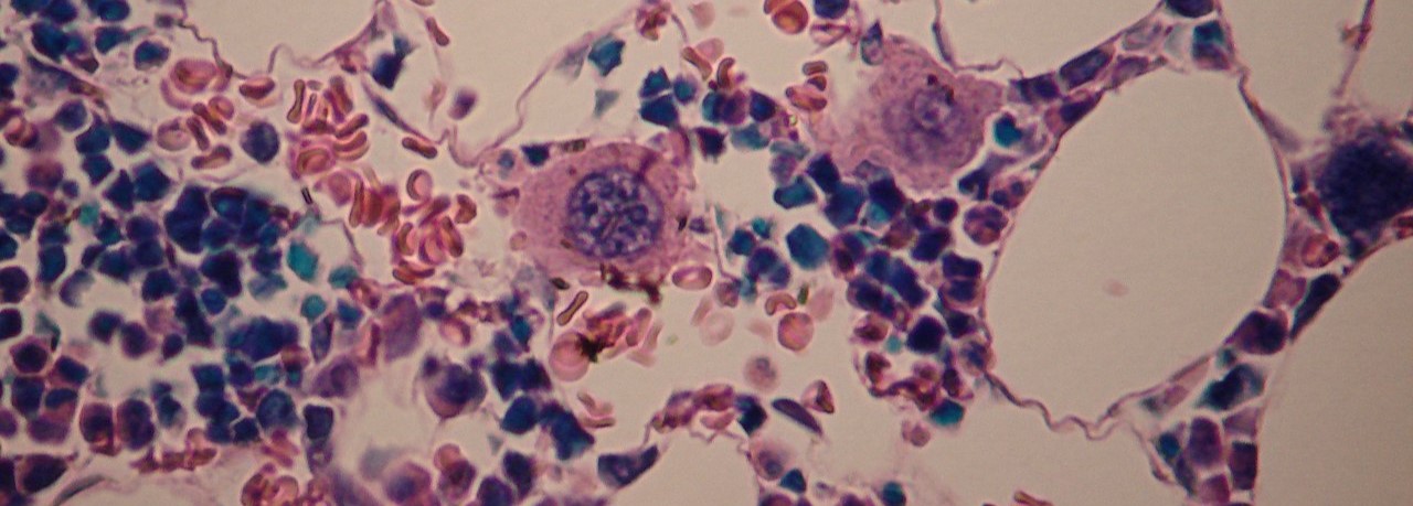 WVSOM_Megakaryocytes